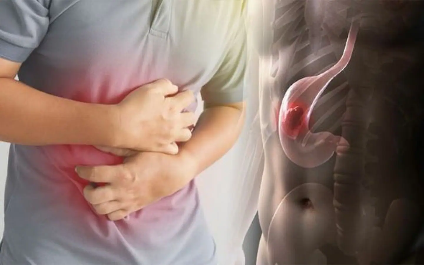 علامات وأعراض سرطان المعدة