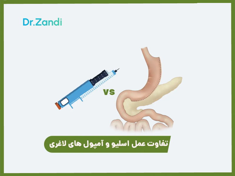 لاغری علمی و مؤثر: مقایسه عمل اسلیو معده و آمپول‌های لاغری