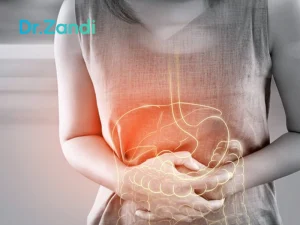 نقش جراحی کولکتومی در مدیریت و درمان قطعی سرطان کولون