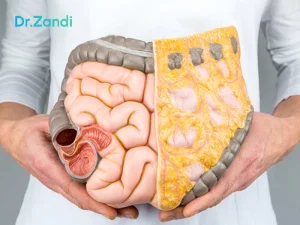 چربی احشایی چیست؟ و روشهای اثر بخش در کاهش آن